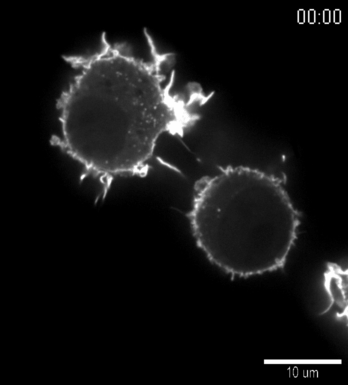 filopodia gif